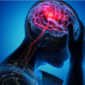 Stroke sebelah kiri 